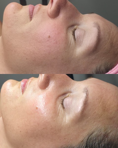 Caleigh Ann Esthetics
