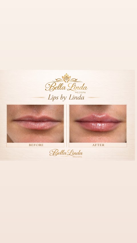 Bella Linda Med Spa