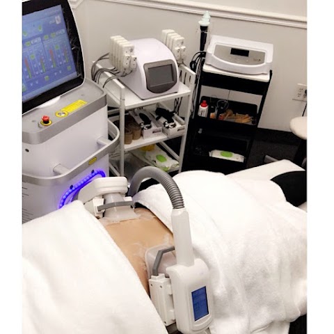Silhouette Body Contouring