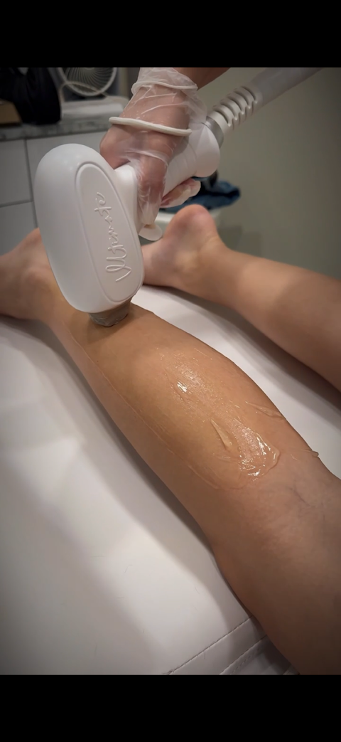 LUMI Laser hair removal Lounge