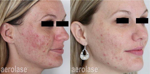 Craft Laser Clinic