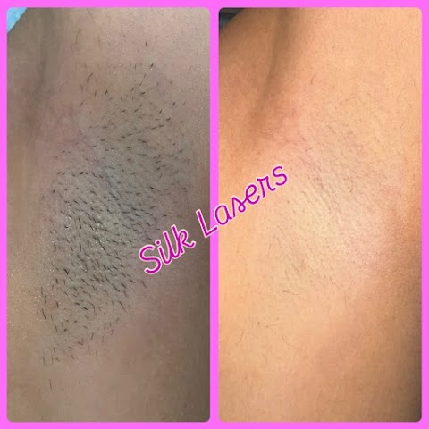 Silk Lasers Inc.