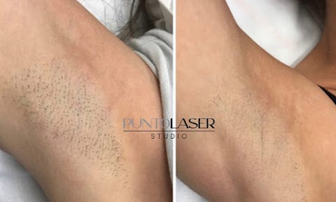 PUNTO LÁSER - Sand Lake / Beauty & Spa