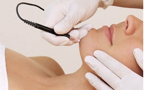 Camille's Electrolysis