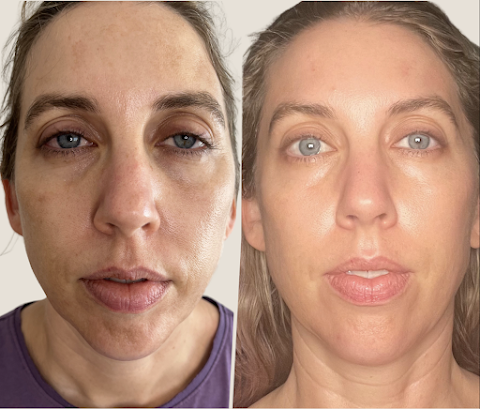 Awakened Skin and Body
