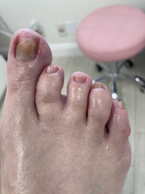 Wellness Pedicures