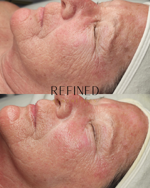 Refined Aesthetics - St. Pete facials and waxing