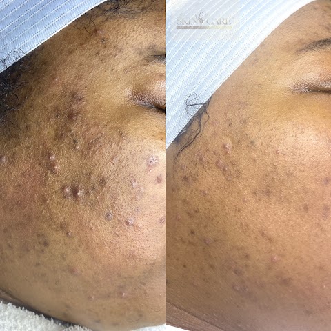 Skincarewithaglowllc