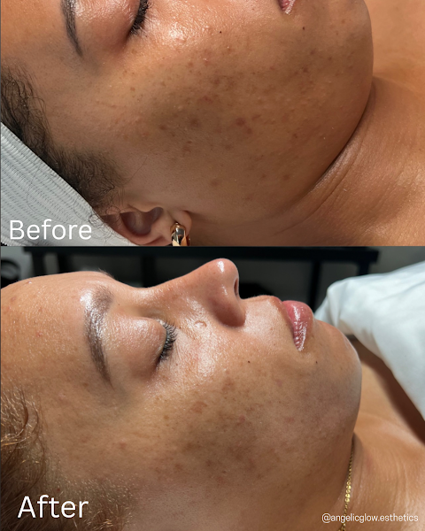 Angelic Glow Esthetics