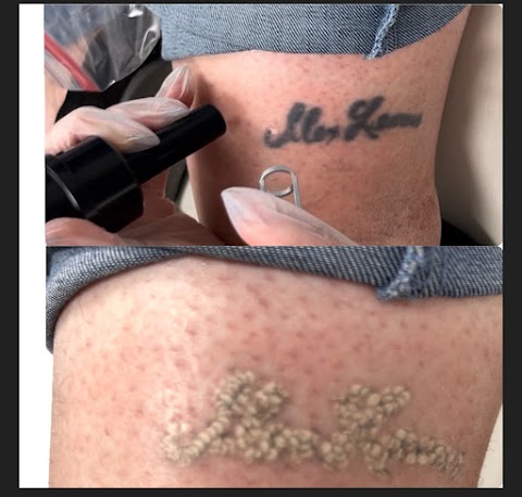 My Laser and Beauty