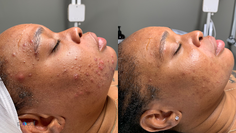 Dream Envyy Med Spa & Recovery