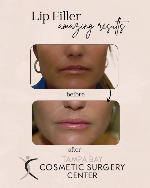 Tampa Bay Cosmetic Surgery Center