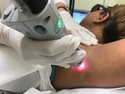 Tropicalaser Beauty Spa