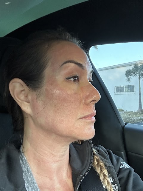 Miranda Beauty & Weight Loss