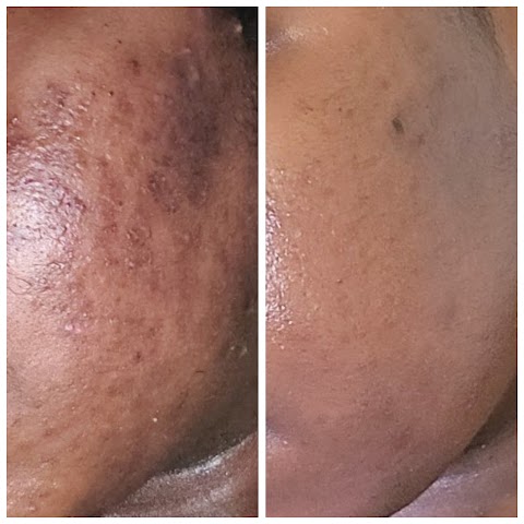 The Skin Alcove