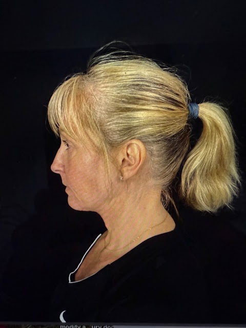 Art Form Plastic Surgery