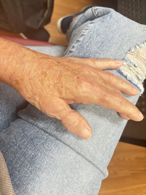 Advanced Hand And Plastic Surgery Center