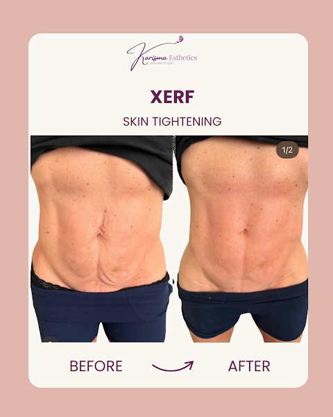 Karisma Esthetics SkinCare Studio