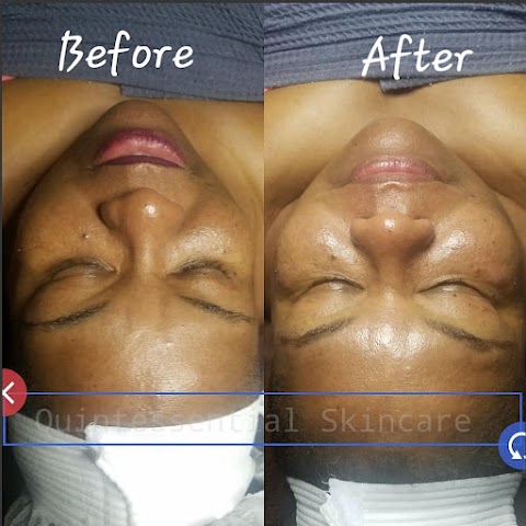 QuintEssential SkinCare