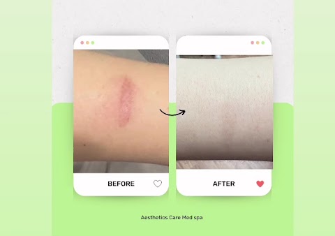 Aesthetics Care Medspa