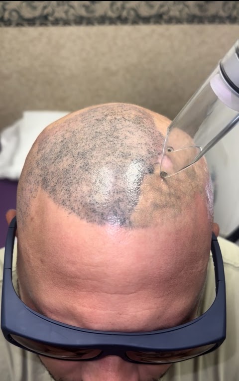 EradiTatt Tattoo Removal of Bradenton/Sarasota