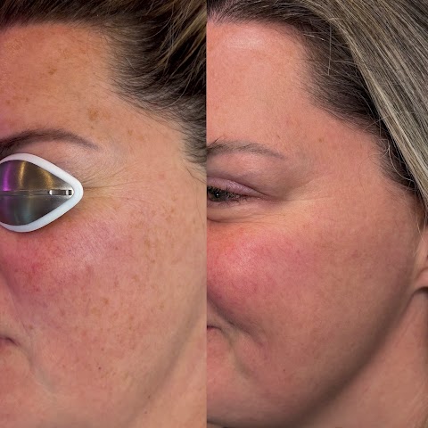 J & P Laser Lounge, LLC