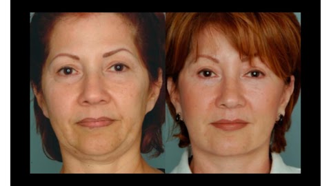 Ramirez Plastic Surgery