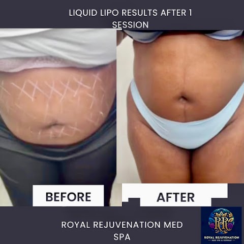 Royal Rejuvenation Med Spa and Retreat