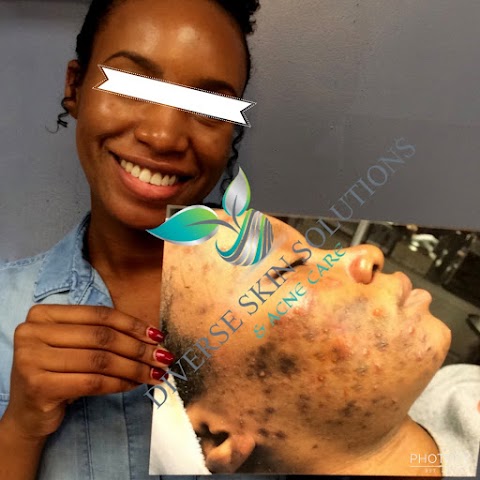 Diverse Skin Solutions & Acne Care
