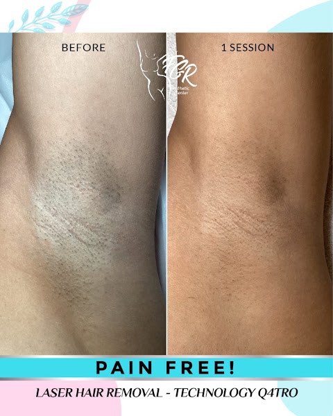 FGR Esthetic Center LLC/ Laser Hair Removal
