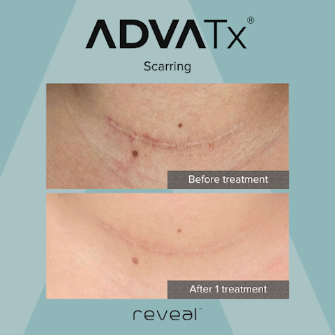 Advance Wellness & Aesthetics of Ocala