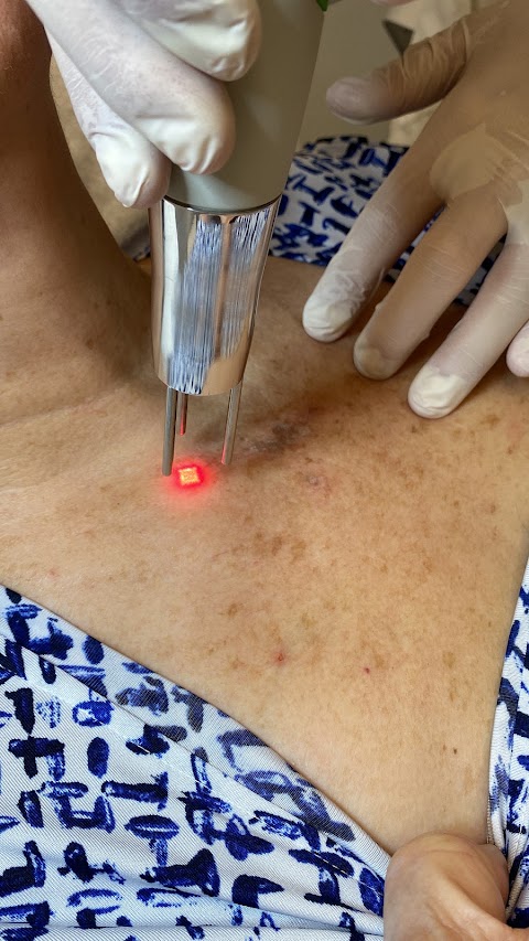 Vanish Laser Services