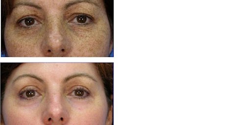 An Institute of Laser Hair Removal and Laser Therapy