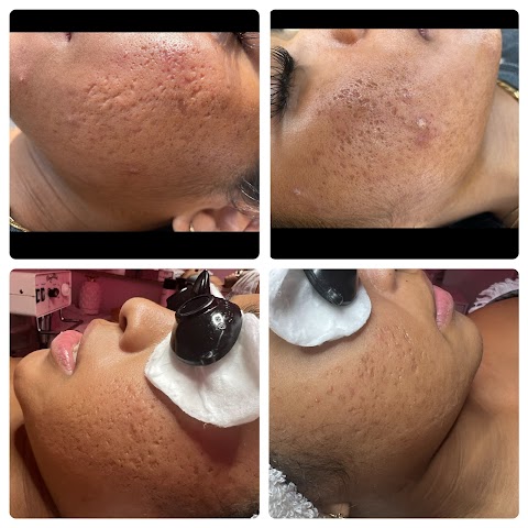 Chevy Skincare