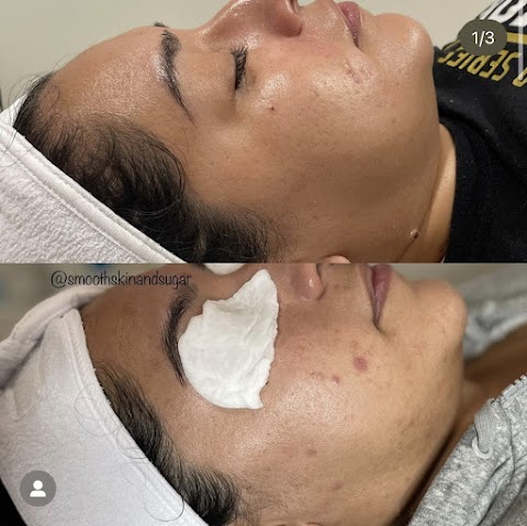 The La Mirada Esthetician - Brazilian Sugaring + Facials