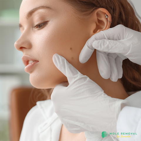Mole Removal Redlands