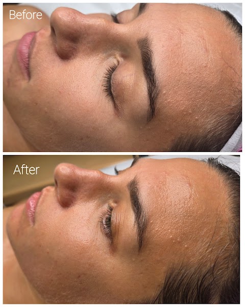 Olga Esthetician — Citrus Heights