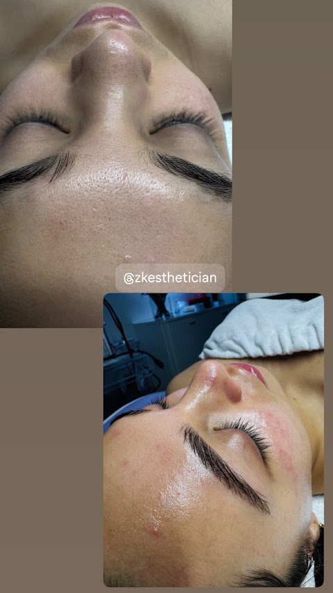 ZK Esthetician