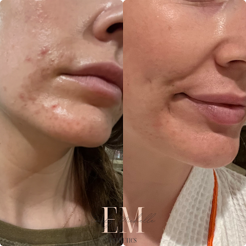 Emily Michelle Esthetics