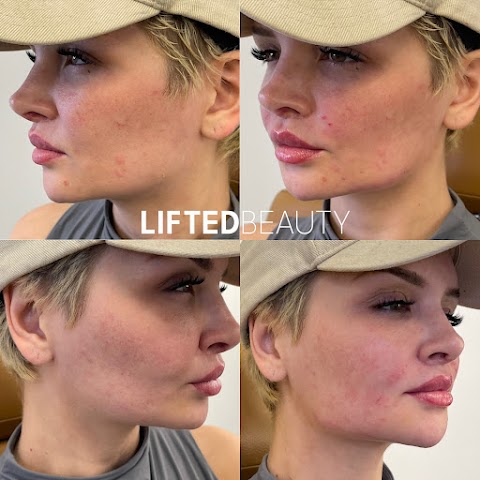 Lifted Beauty Med Spa