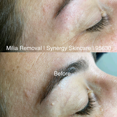 Synergy Skincare
