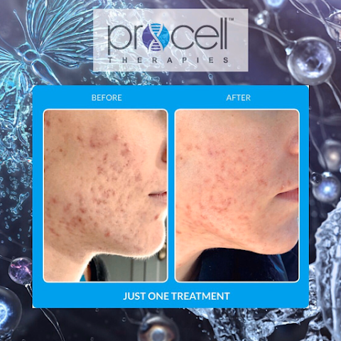Downey Glo2Facial & Hydrafacial MD Skin Studio.