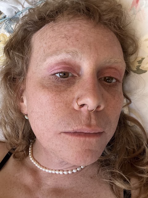 Electrolysis by Janet