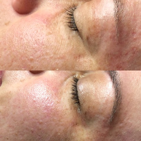 Rochell Overn Esthetics
