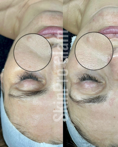 SkinPro Glam - by appointment only!
