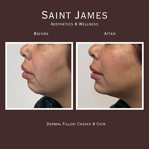Saint James Aesthetics and Wellness
